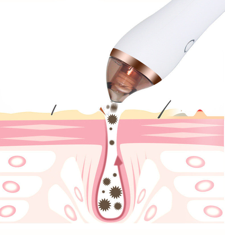 Illustration of a pore vacuum device extracting dirt and blackheads from skin pores