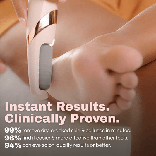 Professional electric callus remover for feet – best rechargeable tool for smooth, soft heels and callus-free skin