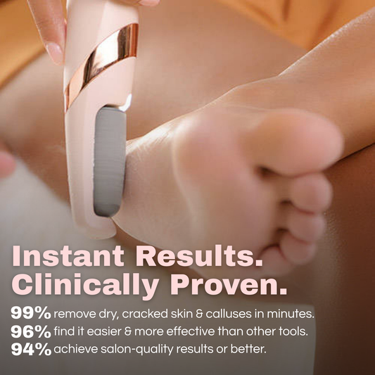 Woman using SmoothFeet™ Electric Callus Remover on dry heels